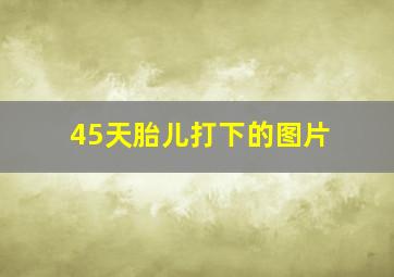 45天胎儿打下的图片