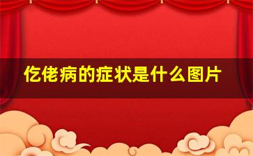 仡佬病的症状是什么图片