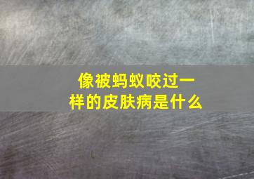 像被蚂蚁咬过一样的皮肤病是什么