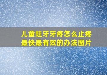 儿童蛀牙牙疼怎么止疼最快最有效的办法图片