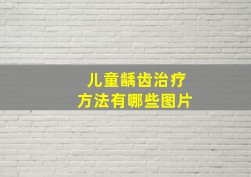 儿童龋齿治疗方法有哪些图片