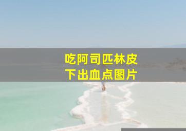 吃阿司匹林皮下出血点图片