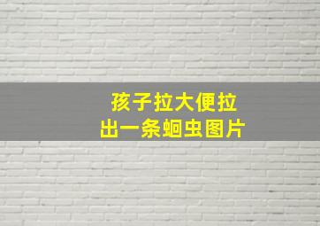 孩子拉大便拉出一条蛔虫图片