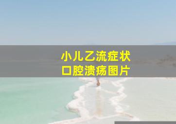 小儿乙流症状口腔溃疡图片