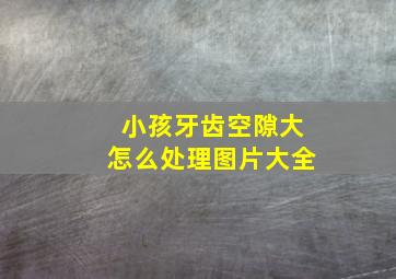 小孩牙齿空隙大怎么处理图片大全