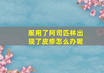 服用了阿司匹林出现了皮疹怎么办呢