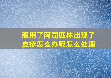 服用了阿司匹林出现了皮疹怎么办呢怎么处理