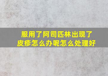 服用了阿司匹林出现了皮疹怎么办呢怎么处理好