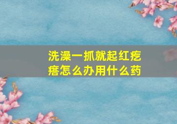 洗澡一抓就起红疙瘩怎么办用什么药