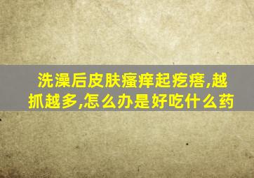 洗澡后皮肤瘙痒起疙瘩,越抓越多,怎么办是好吃什么药