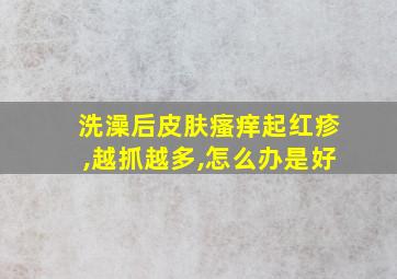 洗澡后皮肤瘙痒起红疹,越抓越多,怎么办是好