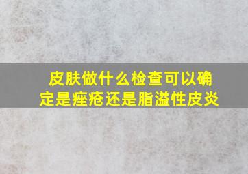 皮肤做什么检查可以确定是痤疮还是脂溢性皮炎