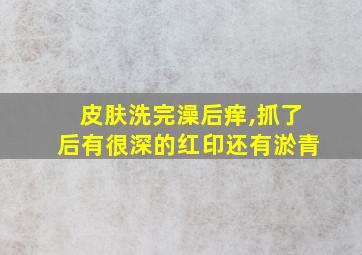 皮肤洗完澡后痒,抓了后有很深的红印还有淤青