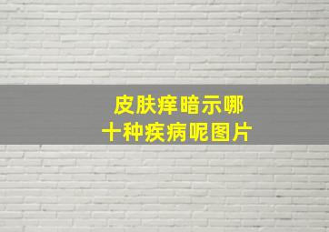 皮肤痒暗示哪十种疾病呢图片