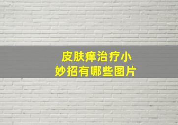 皮肤痒治疗小妙招有哪些图片