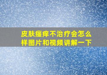 皮肤瘙痒不治疗会怎么样图片和视频讲解一下