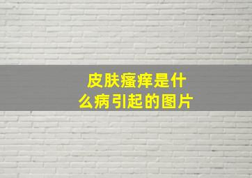 皮肤瘙痒是什么病引起的图片