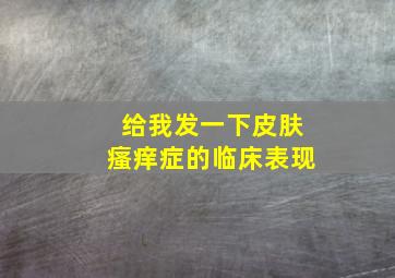 给我发一下皮肤瘙痒症的临床表现