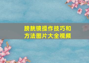 膀胱镜操作技巧和方法图片大全视频