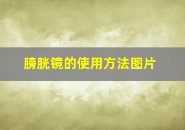 膀胱镜的使用方法图片