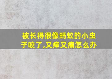 被长得很像蚂蚁的小虫子咬了,又痒又痛怎么办