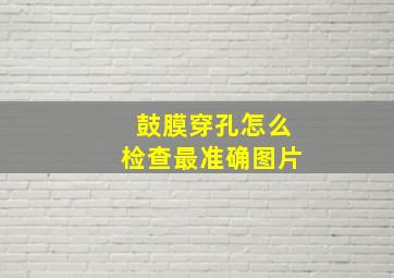 鼓膜穿孔怎么检查最准确图片